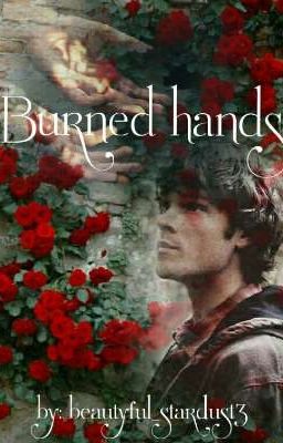 Burned hands [Samifer]