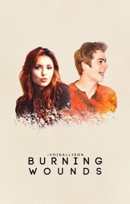 Burning Wounds ≫ Stilinski [2] {DISCONTINUED}