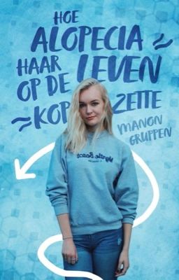 Hoe alopecia haar leven op de kop zette