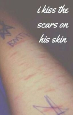 i kiss the scars on his skin (hebrew) 