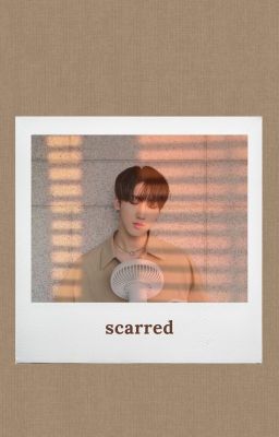 scarred | seo changbin