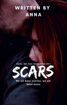 Scars 