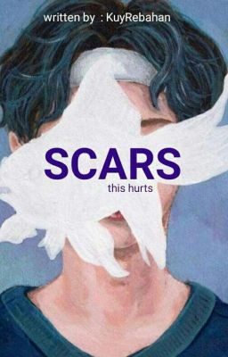 SCARS