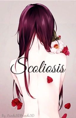 Scoliosis 